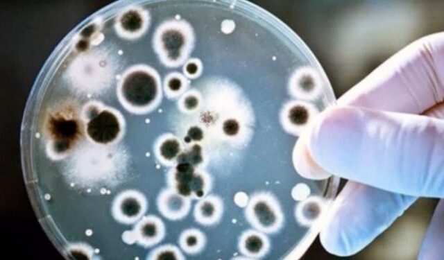 Streptococcus pyogenes, una infección invasiva