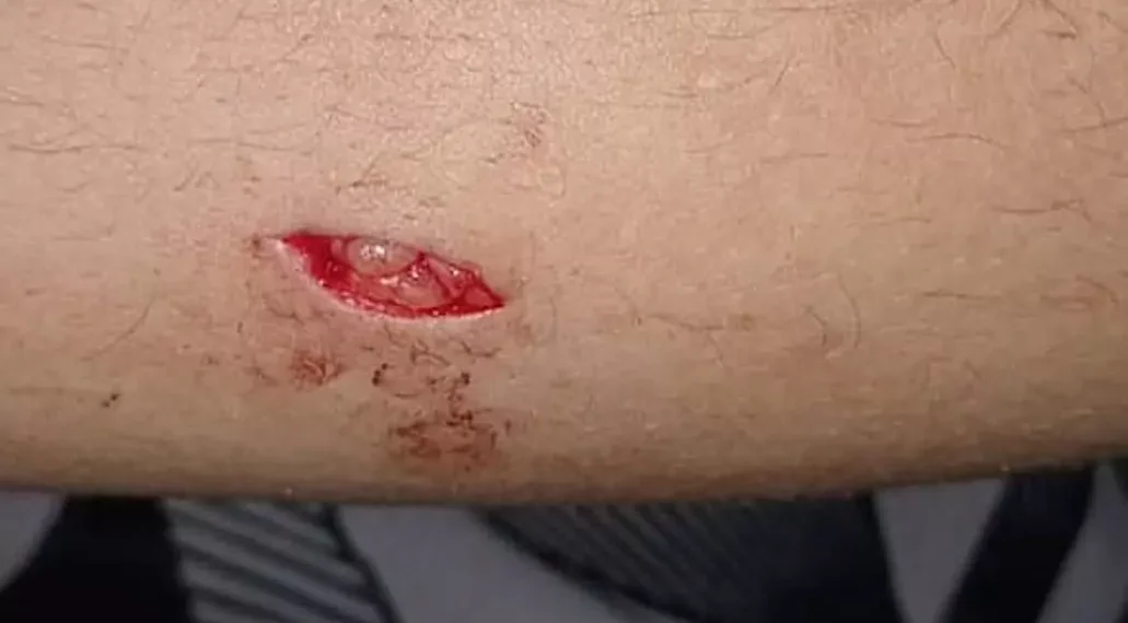 Atacan con arma blanca a un joven y su novia