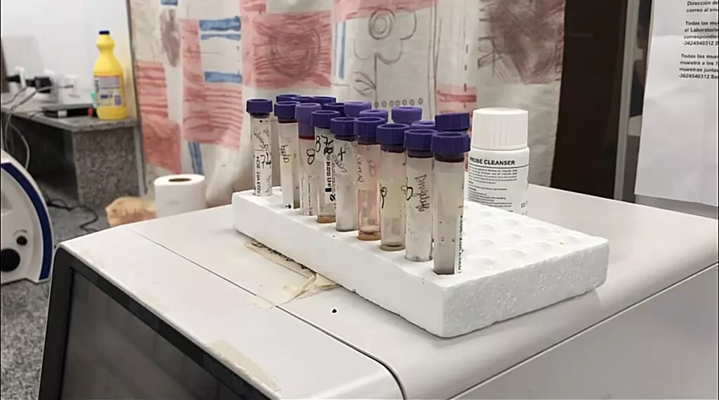 “Los positivos de Dengue en laboratorios privados, son analizados en Hospital”