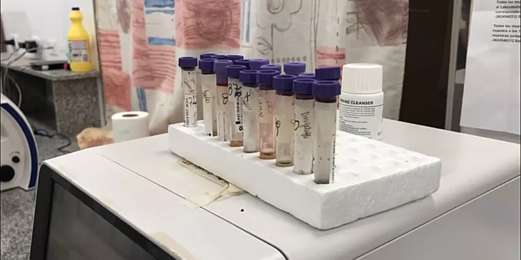 “Los positivos de Dengue en laboratorios privados, son analizados en Hospital”