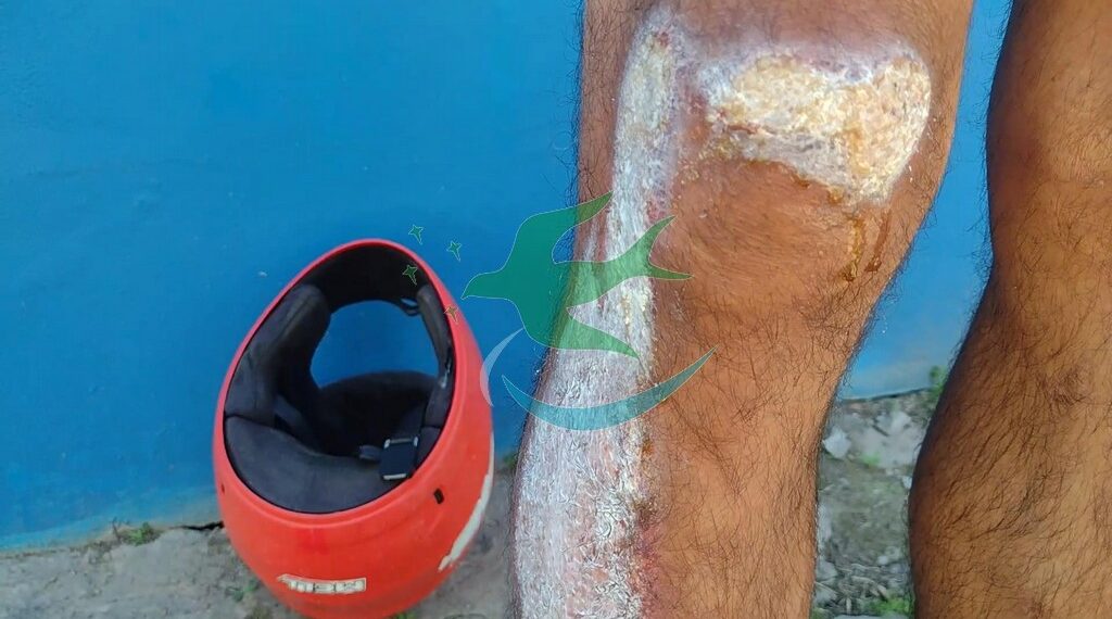 “El casco, mi mejor amigo”