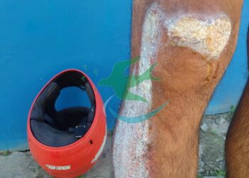 “El casco, mi mejor amigo”