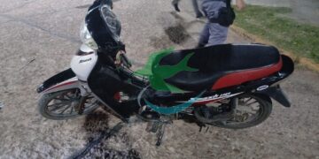 Acompañante de motociclista con lesiones óseas en siniestro vial