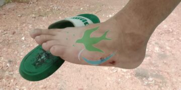 Motociclista atacado por un pitbull en la vía pública